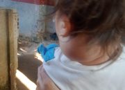 Haru! Balita Asal Kronjo Derita Tumor di Leher, Butuh Uluran Tangan Dermawan