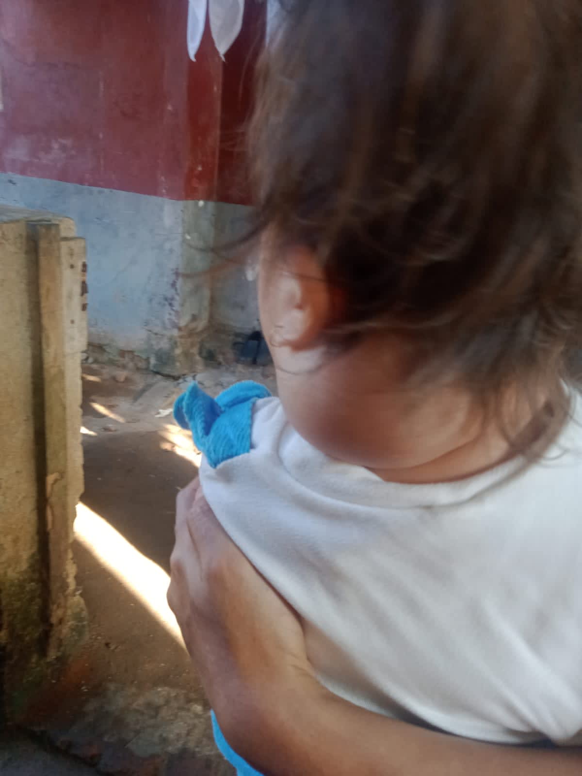 Haru! Balita Asal Kronjo Derita Tumor di Leher, Butuh Uluran Tangan Dermawan