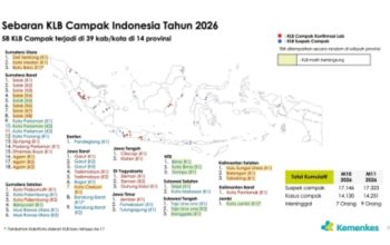 Waspada! Lonjakan Campak Mengintai, Kemenkes Tetapkan 10 Daerah Darurat dan Wajibkan Imunisasi Massal